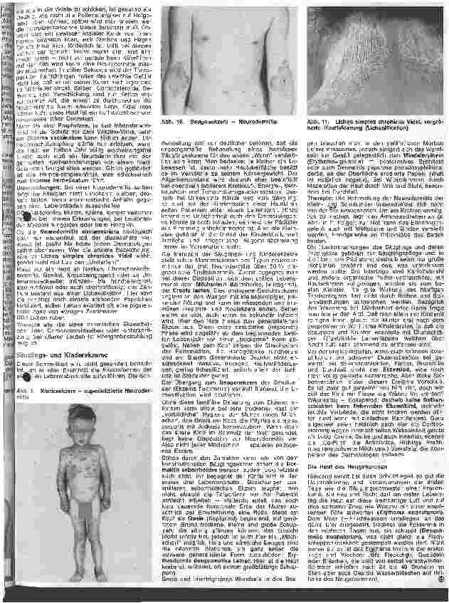 Vorschauseite 4: Der hautkranke Patient 6. Folge Spezielle Dermatologie: Ekzeme und Unverträglichkeitsreaktionen III