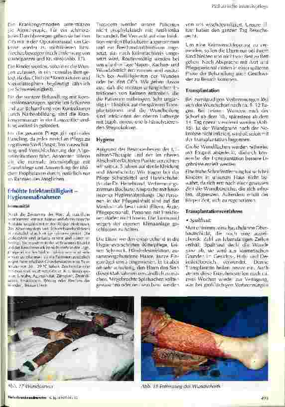 Vorschauseite 6: Besonderheiten bei der Versorgung des schwerbrandverletzten Kindes