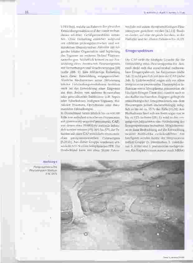 Vorschauseite 3: Das Pleuraempyem eine interdisziplinäre Herausforderung