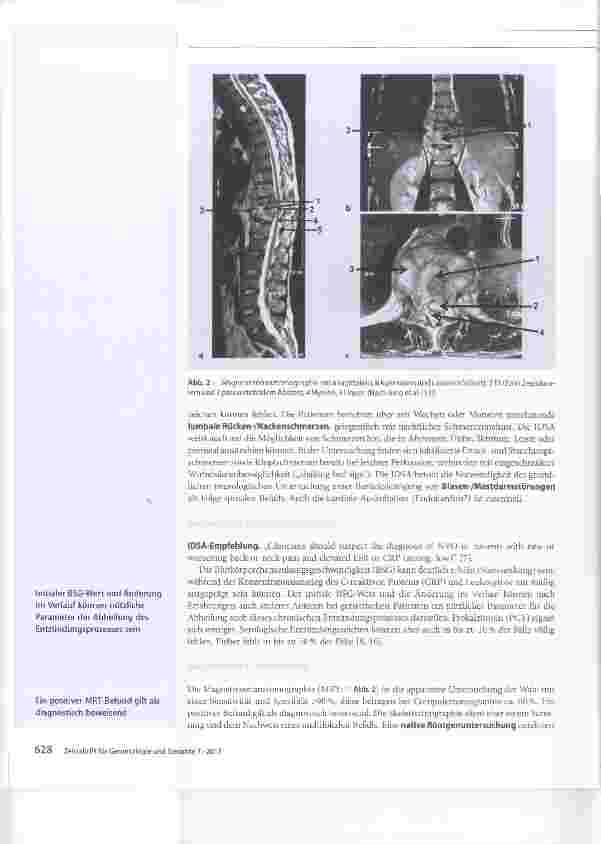 Vorschauseite 6: Chamäleon Spondylodiszitis. Herausforderung für den Geriater