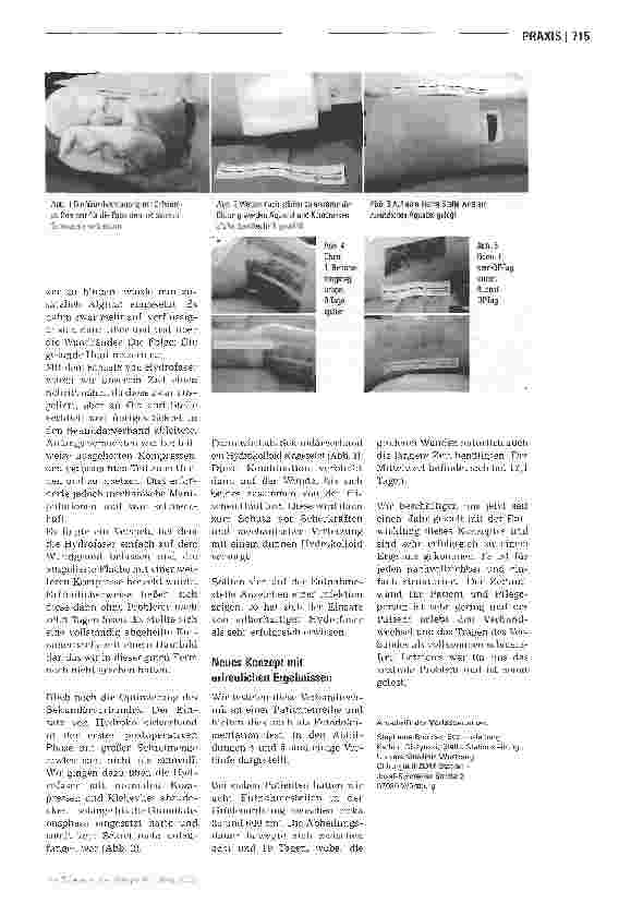 Vorschauseite 2: Hauttransplantation ohne Schmerzen