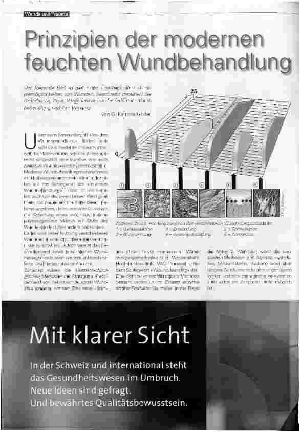 Vorschauseite 1: Prinzipien der modernen feuchten Wundbehandlung