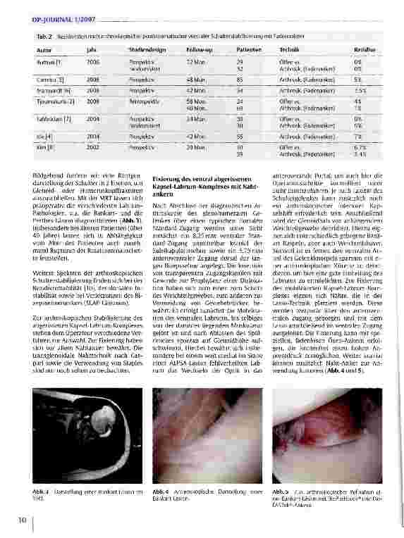 Vorschauseite 3: Arthroskopische Chirurgie an der Schulter
