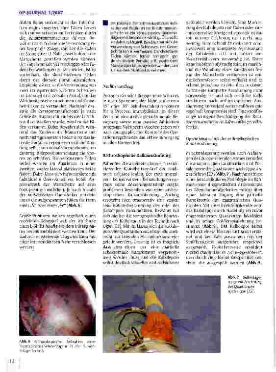 Vorschauseite 5: Arthroskopische Chirurgie an der Schulter