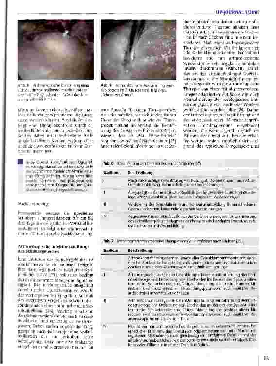 Vorschauseite 6: Arthroskopische Chirurgie an der Schulter