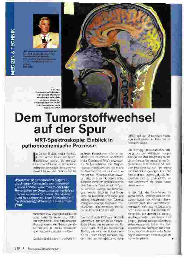Vorschauseite 1: Dem Tumorstoffwechsel auf der Spur