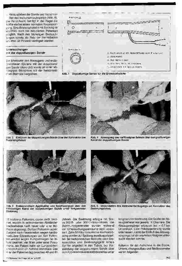Vorschauseite 2: Anwendung eines neuen doppellumigen Katheters in der Intensivbehandlung // Verbesserte Bronchialtoilette