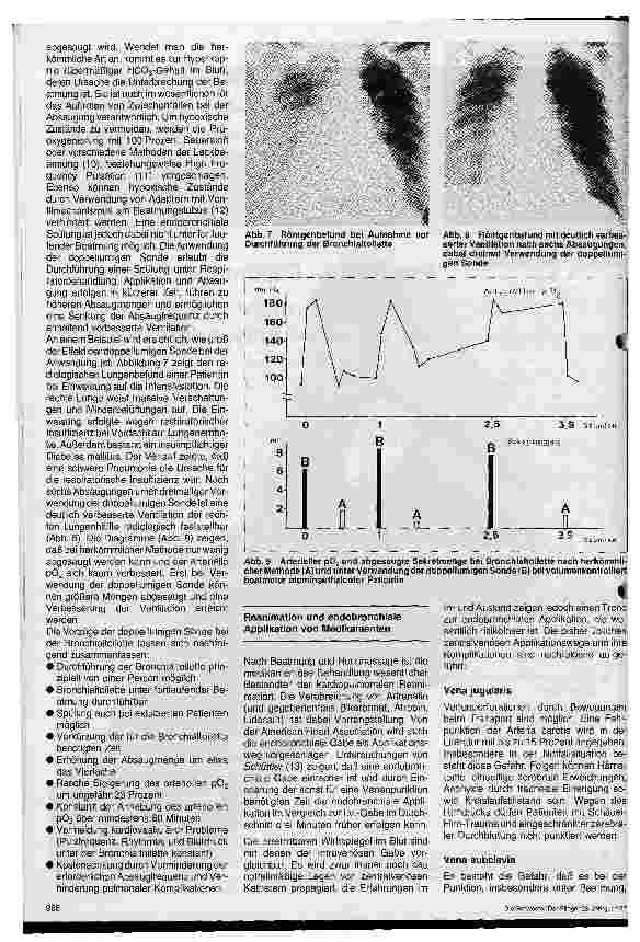 Vorschauseite 4: Anwendung eines neuen doppellumigen Katheters in der Intensivbehandlung // Verbesserte Bronchialtoilette