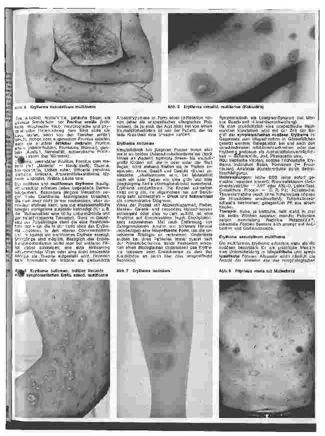 Vorschauseite 2: Der hautkranke Patient 7. Folge: Spezielle Dermatologie: Ekzeme und Unverträglichkeitsreaktionen IV