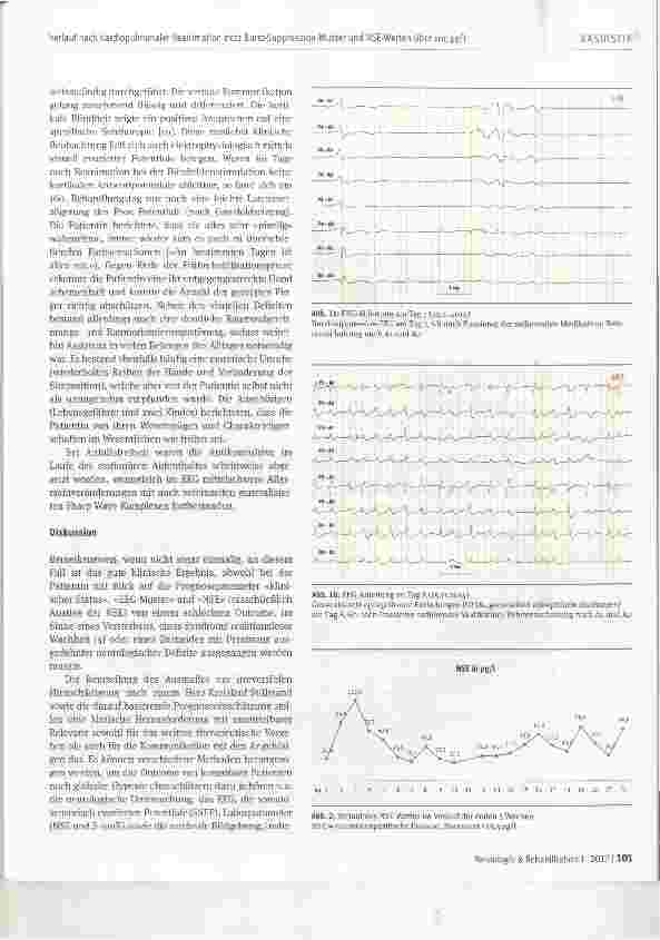 Vorschauseite 3: Ein erstaunlich guter Verlauf bei einer Patientin nach kardiopulmonaler Reanimation trotz Burst-Suppression-Muster und NSE-Werten Uber 100 pg/l