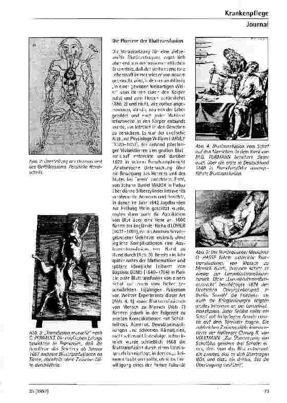 Vorschauseite 2: Die Bluttransfusion im Wandel der Zeit