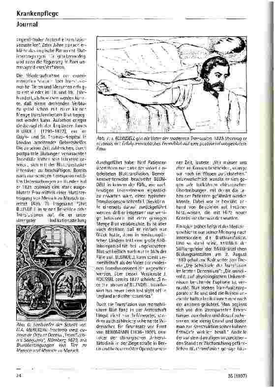Vorschauseite 3: Die Bluttransfusion im Wandel der Zeit