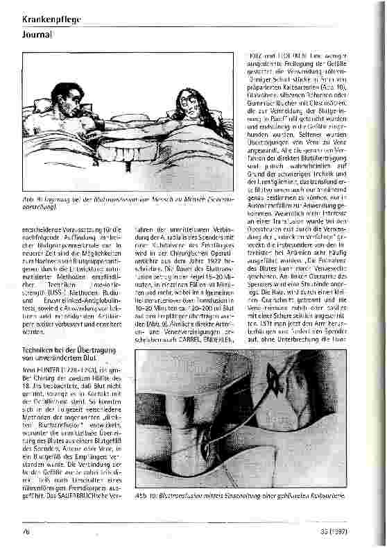 Vorschauseite 5: Die Bluttransfusion im Wandel der Zeit