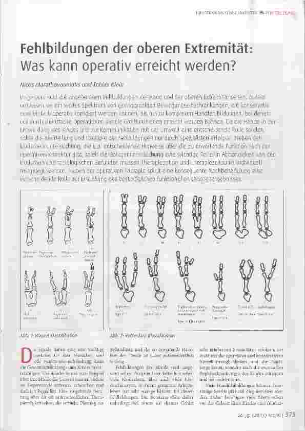 Vorschauseite 1: Fehlbildungen der oberen Extremität: Was kann operativ erreicht werden?