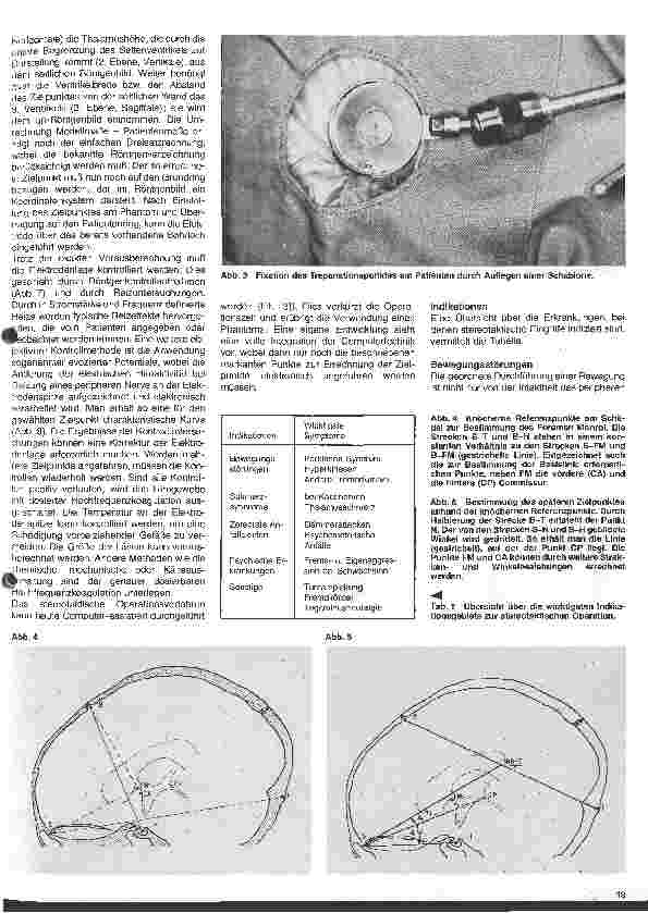 Vorschauseite 2: Themen aus der Neurochirurgie 12 Folge: Stereotaktische Operationen