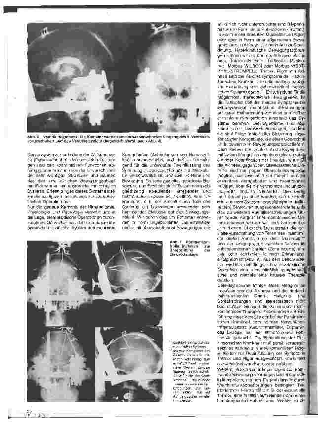 Vorschauseite 3: Themen aus der Neurochirurgie 12 Folge: Stereotaktische Operationen