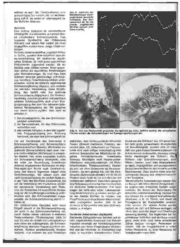 Vorschauseite 4: Themen aus der Neurochirurgie 12 Folge: Stereotaktische Operationen