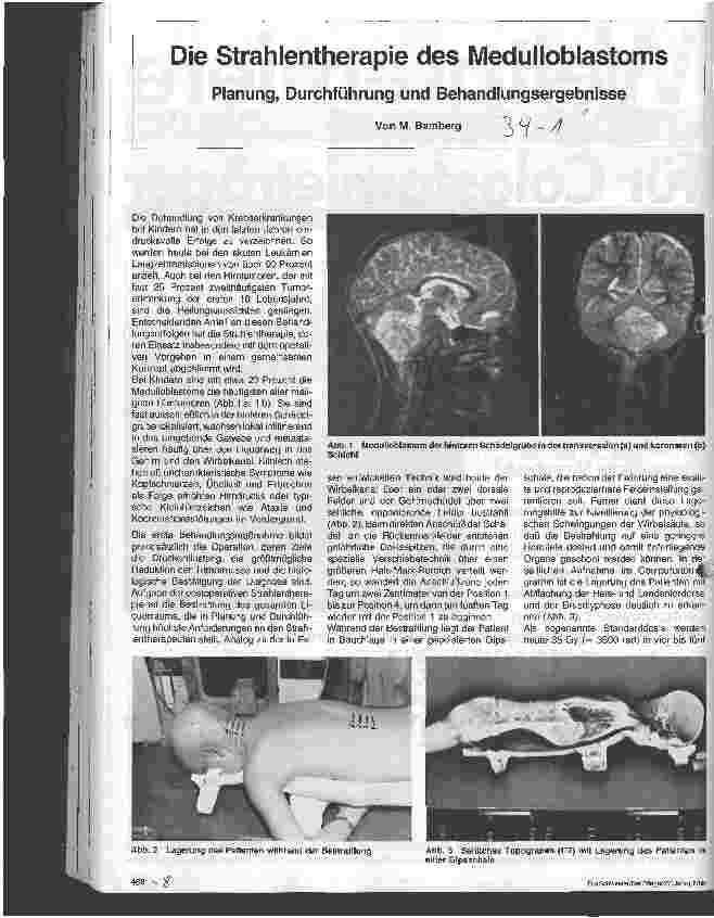 Vorschauseite 1: Die Strahlentherapie der Medulloblastoms