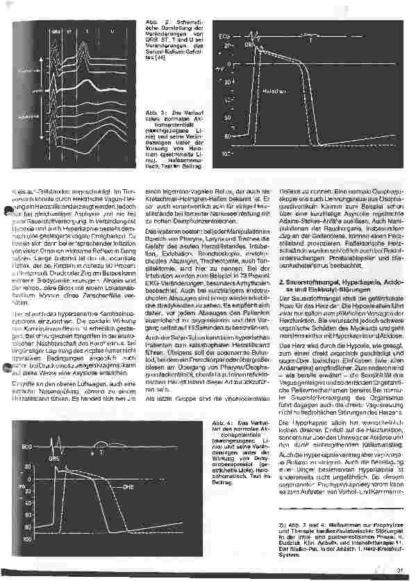 Vorschauseite 2: Aktuelle Themen aus Intensivmedizin und Anästhesiologie 11.Folge: Herz-Kreislauf-Stillstand während der Narkose (Teil I) Ursachen