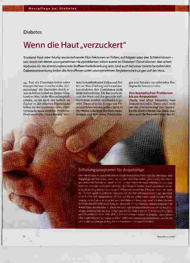 Vorschauseite 1: Wenn die Haut „verzuckert