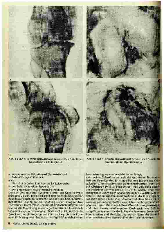 Vorschauseite 2: Degenerative Gelenkerkrankungen