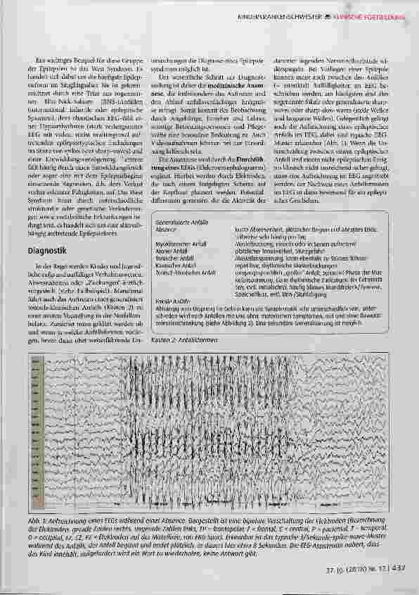 Vorschauseite 4: Epilepsien im Kindesund Jugendalter