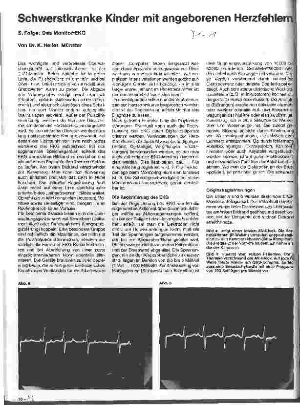Vorschauseite 1: Schwerstkranke Kinder mit angeborenen Herzfehlern 5. Folge: Das Monitor-EKG