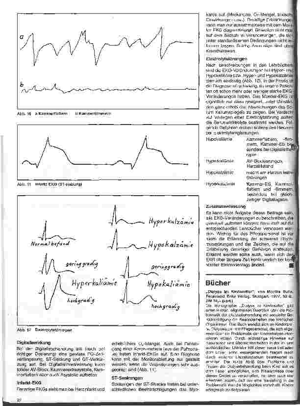 Vorschauseite 5: Schwerstkranke Kinder mit angeborenen Herzfehlern 5. Folge: Das Monitor-EKG