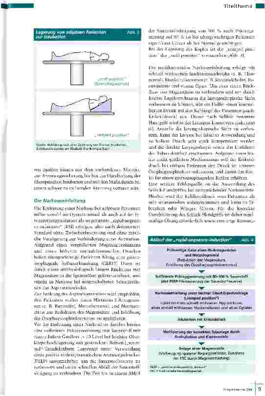 Vorschauseite 4: Ein „schwergewichtiges Problem
