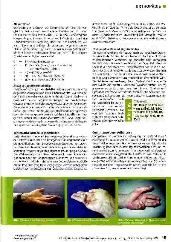 Vorschauseite 2: Welche Faktoren wirken sich auf die Compliance von Patienten mit der Dupuytren-Krankheit beim Tragen von Schienen aus?
