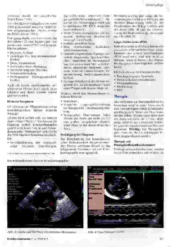 Vorschauseite 3: Medikamentöse Therapie des persistierenden Ductus arteriosus ßotalli beim frühgeborenen Kind aus pflegerischer Sicht