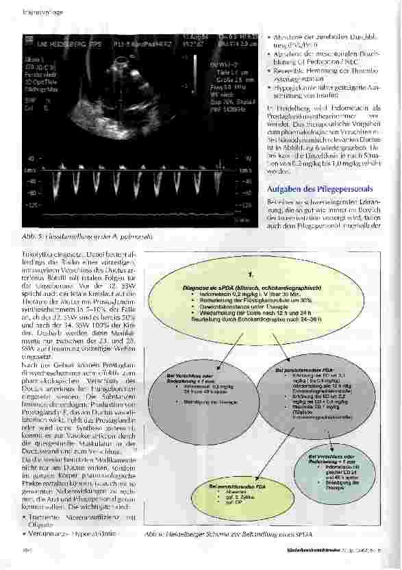 Vorschauseite 4: Medikamentöse Therapie des persistierenden Ductus arteriosus ßotalli beim frühgeborenen Kind aus pflegerischer Sicht