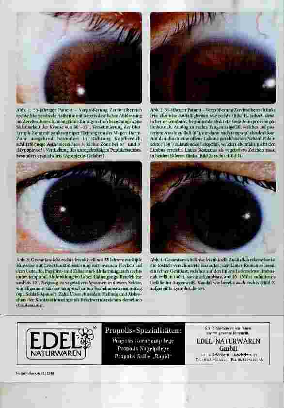 Vorschauseite 2: Das Rezept aus dem Auge