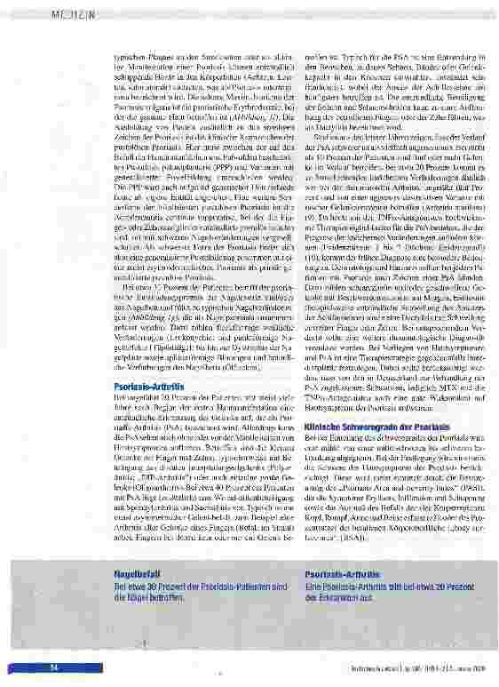 Vorschauseite 4: Psoriasis - neue Erkenntnisse zur Pathogenese und Therapie