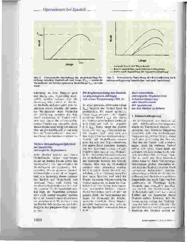 Vorschauseite 4: Pathophysiologische Grundlagen der Spastik und die klinischen Auswirkungen von Operationen an Muskeln und Sehnen