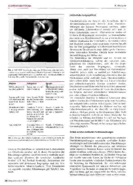 Vorschauseite 5: Therapie vestibulären Schwindels bei älteren Patienten