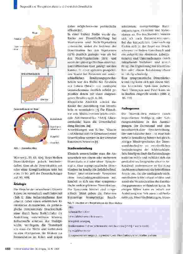 Vorschauseite 2: Diagnostik und Therapie der akuten und chronischen Divertikulitis
