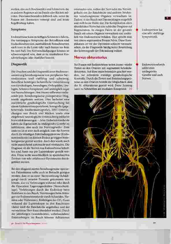 Vorschauseite 2: Nervenirritation durch Endometriose