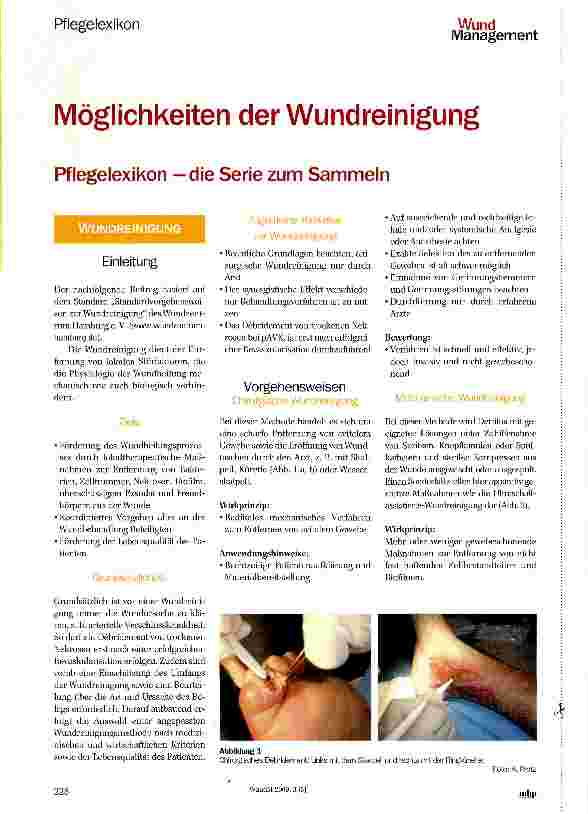 Vorschauseite 1: Möglichkeiten der Wundreinigung