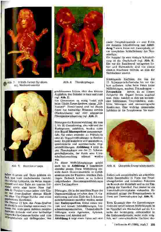 Vorschauseite 2: Pränatale Diagnostik und Mißbildungen