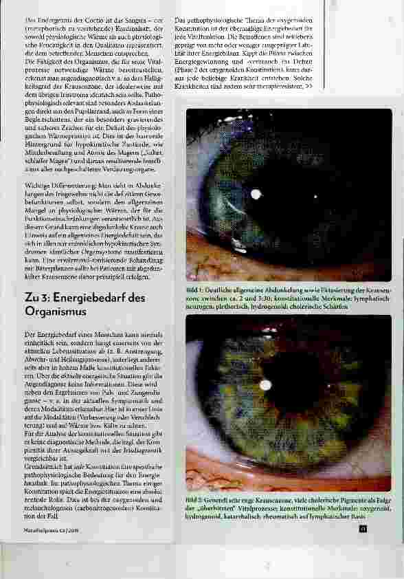 Vorschauseite 2: Die Energiesituation in der Augendiagnose