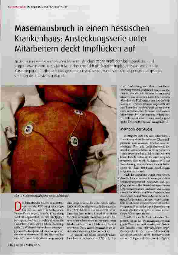 Vorschauseite 1: Masernausbruch in einem hessischen Krankenhaus: Ansteckungsserie unter Mitarbeitern deckt Impflücken auf