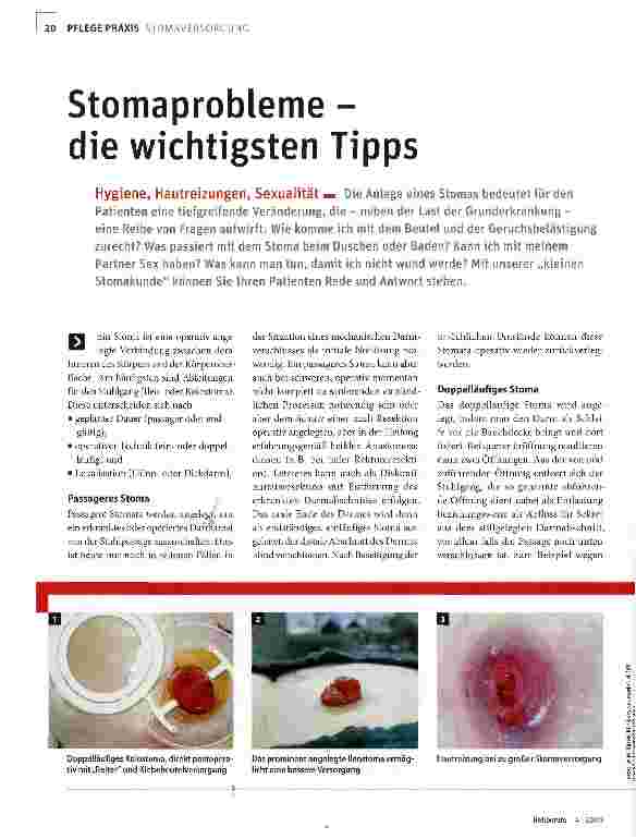 Vorschauseite 1: Stomaprobleme -die wichtigsten Tipps