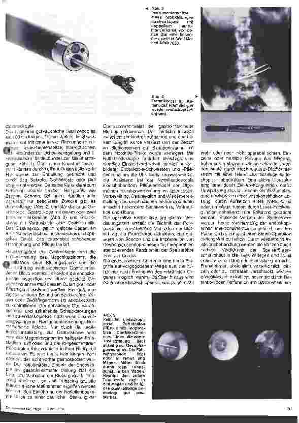 Vorschauseite 2: Endoskopie in der Chirurgie