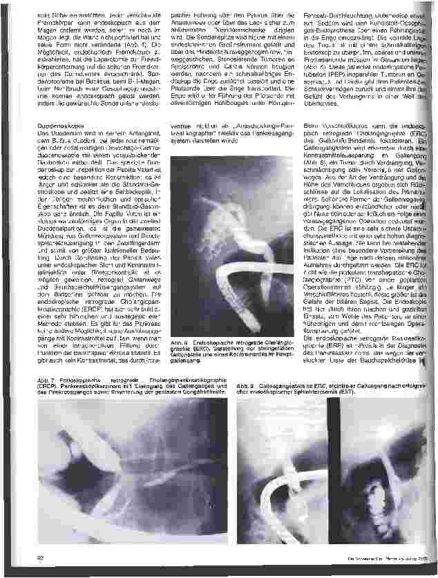 Vorschauseite 3: Endoskopie in der Chirurgie