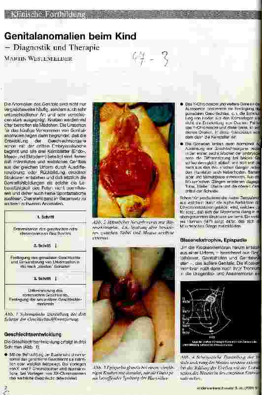 Vorschauseite 1: Genitalanomalien beim Kind - Diagnostik und Therapie -