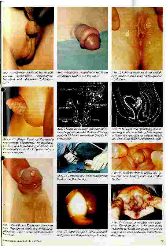 Vorschauseite 2: Genitalanomalien beim Kind - Diagnostik und Therapie -