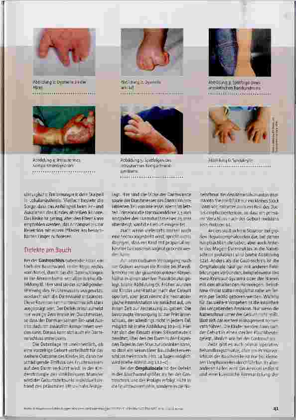 Vorschauseite 2: Was kann die Kinderchirurgie?
