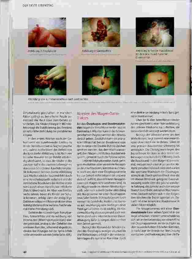 Vorschauseite 3: Was kann die Kinderchirurgie?