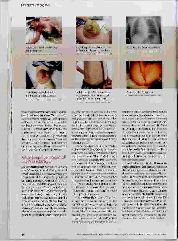 Vorschauseite 5: Was kann die Kinderchirurgie?